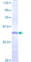 12.5% SDS-PAGE Stained with Coomassie Blue.